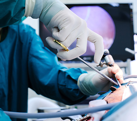 Histerectomía por laparoscopia en Bogotá, médico operando